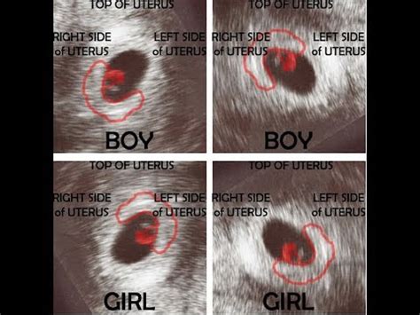 How many weeks to find out sex of baby